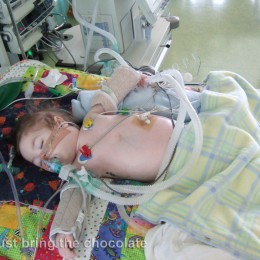 Dominic in Intensive care swollen