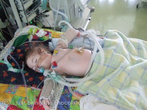 Dominic in Intensive care swollen