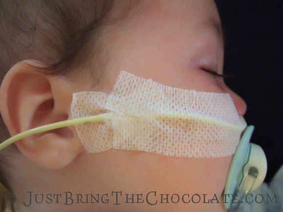 how to tape a ng feeding tube