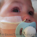 how to tape a ng feeding tube
